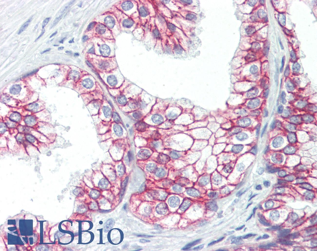 IHC-plus™ Monoclonal Mouse anti-Human CTNNB1 / Beta Catenin Antibody (aa758-771, IHC, WB)