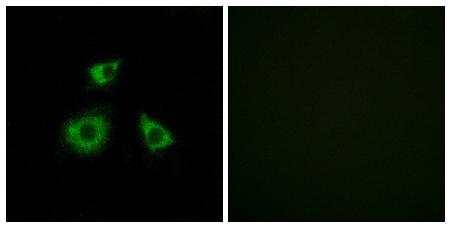 MRPL52 Antibody