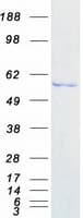 Human DDX6 Protein (Recombinant Myc-DDK (Flag))