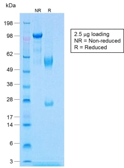 Recombinant Monoclonal Rabbit anti-Human CNN1 / Calponin Antibody (clone CNN1/1408R, Azide-free,Carrier-free, IHC, IF)