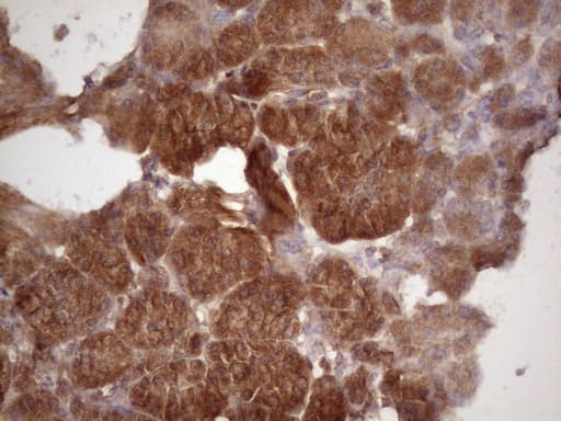 Monoclonal Mouse anti-Human HAVCR2 / TIM-3 Antibody (clone OTI2E2, aa22-202, IHC)