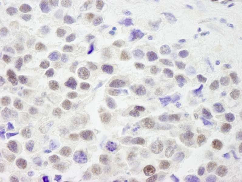 RCOR3 Antibody (aa445-495)