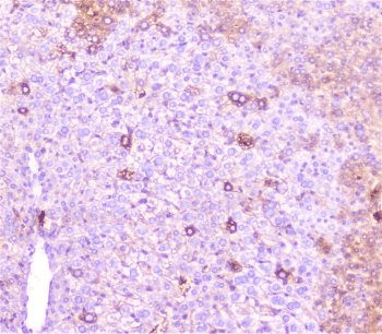 Polyclonal Rabbit anti-Human CRP / C-Reactive Protein Antibody (IHC, WB)