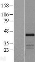 SSDP1 / SSBP3 Protein (Over-Expression Lysate Myc-DDK (Flag))
