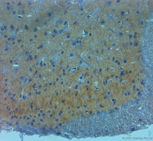 GRIN3A / NR3A Antibody (aa990-1040)