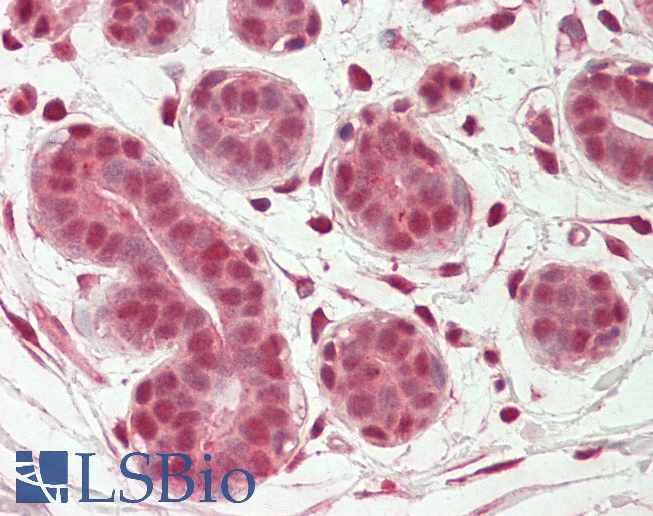 IHC-plus™ Polyclonal Goat anti-Human OAS2 Antibody (Internal Region, IHC, WB)