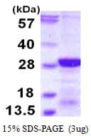 Human RCAN2 / RCN2 Protein (Recombinant His)