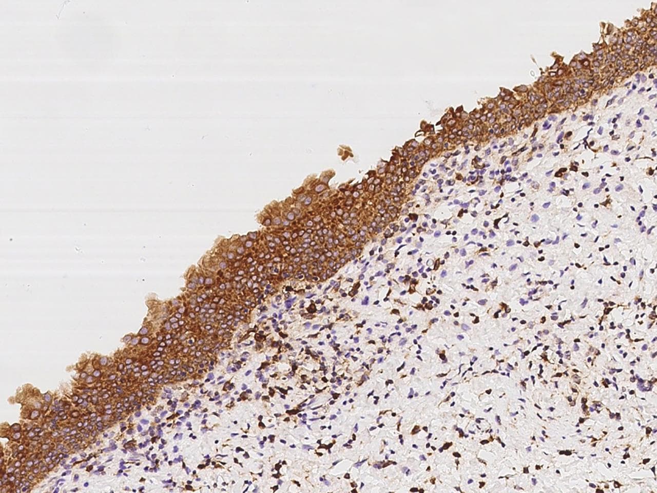 APOL2 / Apolipoprotein L 2 Antibody