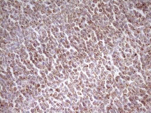 MRRF Antibody (aa56-262, clone OTI2A8)