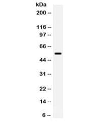 ALK-6 / BMPR1B Antibody
