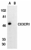 Polyclonal Rabbit anti-Human CX3CR1 Antibody (IHC, IF, WB)