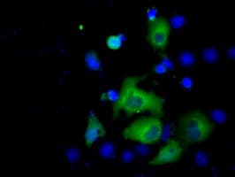 ACAT2 Antibody (clone OTI3A11, Carrier-free)