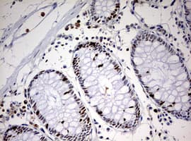 Monoclonal Mouse anti-Human TOP2A / Topoisomerase II Alpha Antibody (clone OTI2D12, aa1100-1531, IHC, WB)