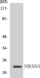 Polyclonal Rabbit anti-Human MRPL22 Antibody (aa82-131, WB)