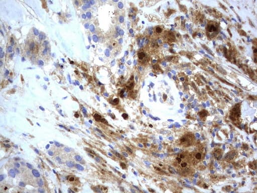 Monoclonal Mouse anti-Human BID Antibody (clone UMAB139, IHC, WB)