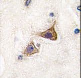 JPH3 Antibody (aa549-578)