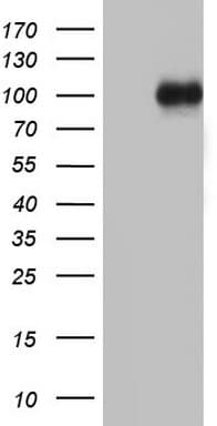 Monoclonal Mouse anti-Human MDM2 Antibody (clone OTI25B9, aa119-438, WB)