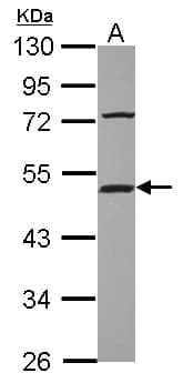 Polyclonal Rabbit anti-Human ST13 Antibody (WB)