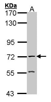 ACHE / Acetylcholinesterase Antibody (aa406-614)