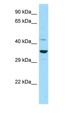 IDO2 / INDOL1 Antibody (aa53-102)