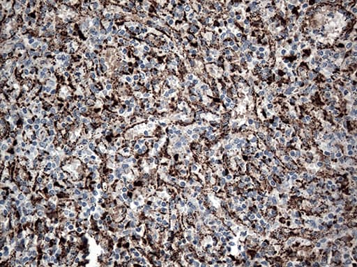 CTSL / Cathepsin L Antibody (aa114-333, clone OTI6D5, Carrier-free)