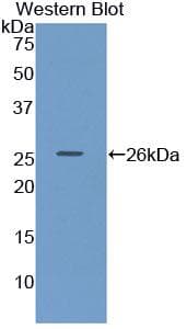 LIPC / Hepatic Lipase Antibody (aa25-247)