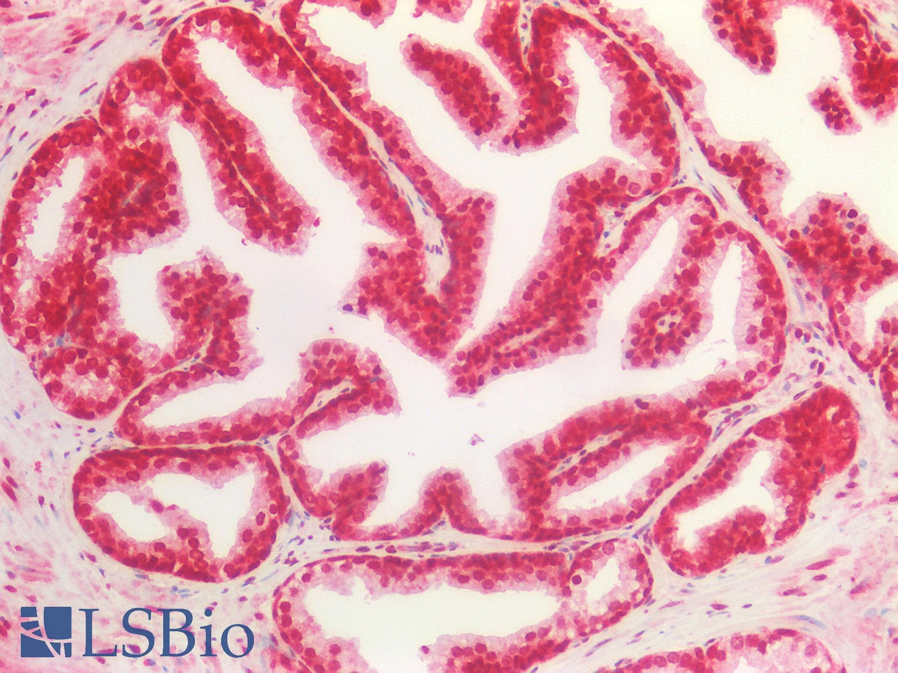 IHC-plus™ Polyclonal Rabbit anti-Human CD276 / B7-H3 Antibody (aa493-522, IHC, IF, WB)