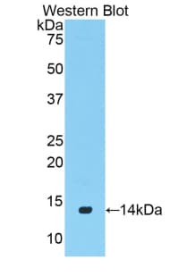 VG5Q / AGGF1 Antibody (aa21-123, APC)