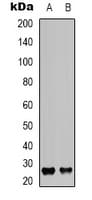 IHC-plus™ Polyclonal Rabbit anti-Human CD81 Antibody (Internal, IHC, WB)