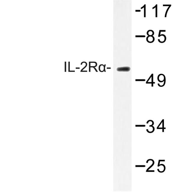 IL2RA / CD25 Antibody (Arg264)