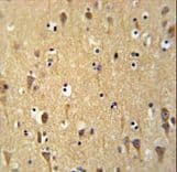 WDR73 Antibody (aa44-73)
