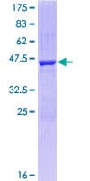 Human CDC42 Protein (Recombinant GST)