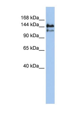 SPT5 / SUPT5H Antibody (aa396-445)