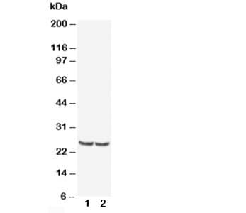 TIMP4 Antibody (aa208-224)