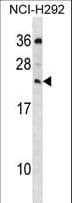 MED19 Antibody (aa161-188)