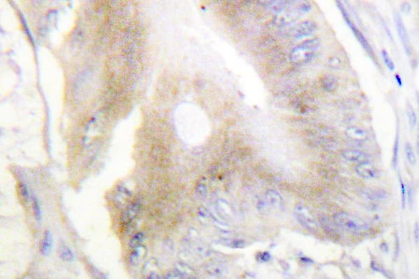 ACO1 / Aconitase Antibody (Arg134)