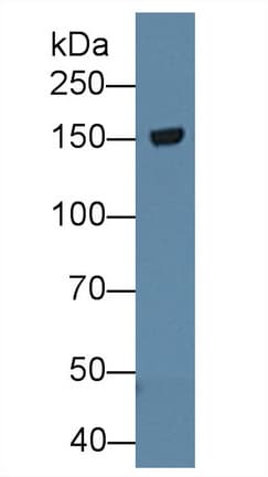 TNR / Tenascin R Antibody