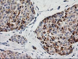 AK4 / Adenylate Kinase 4 Antibody (clone OTI5E7, Carrier-free)