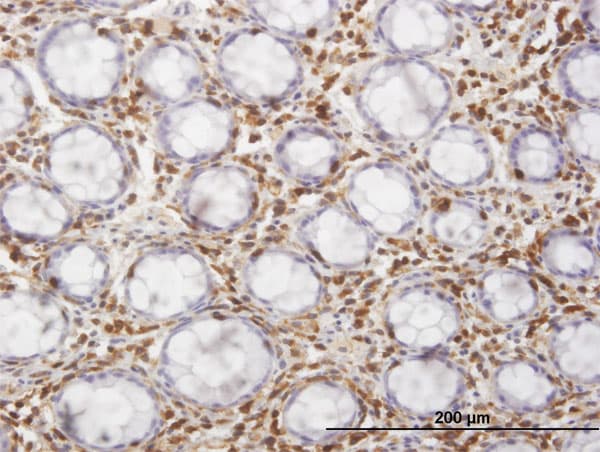 HCLS1 Antibody (clone 3F4)
