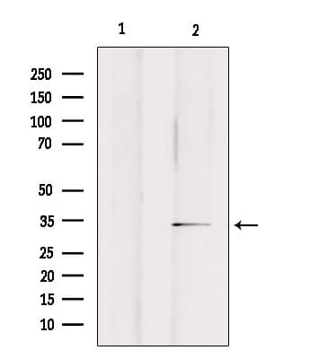 OR2A25 Antibody