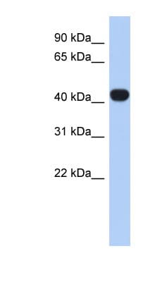 Polyclonal Rabbit anti-Human RASGEF1C Antibody (N-Terminus, WB)