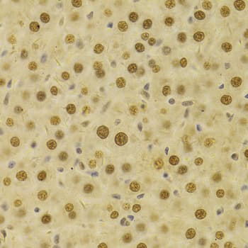 HDGF Antibody