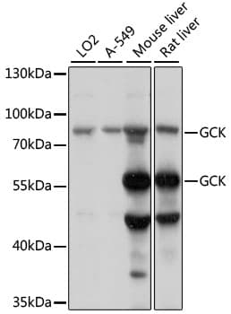GCK / Glucokinase Antibody
