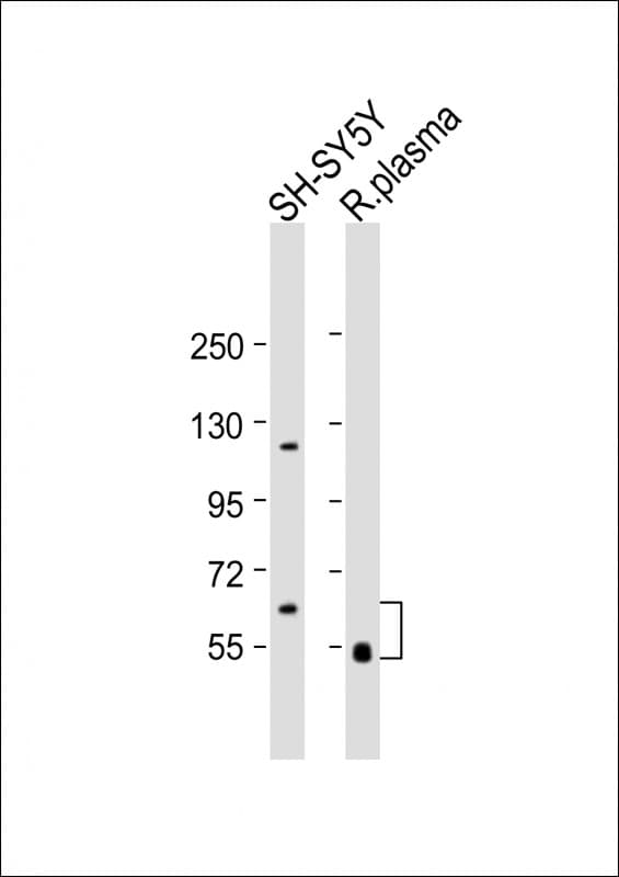 GAS6 Antibody (Internal)