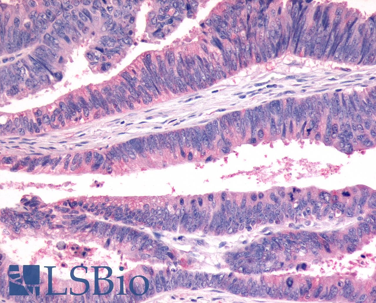 PathPlus™ Polyclonal Rabbit anti-Human FZD7 / Frizzled 7 Antibody (N-Terminus, IHC)