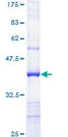 Human PPARG / PPAR Gamma Protein (Recombinant GST, N-terminus)
