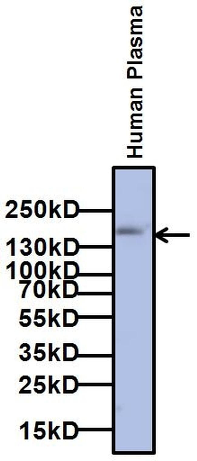 A2M / Alpha-2-Macroglobulin Antibody (clone F1-P1C11 #3)