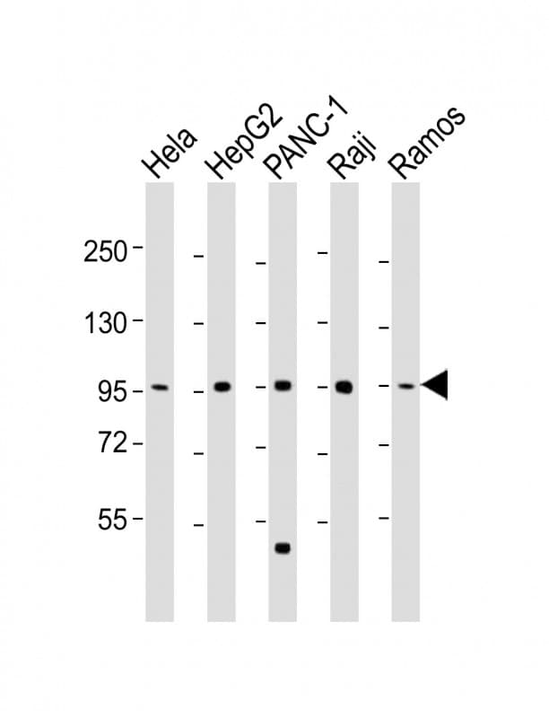 Polyclonal Rabbit anti-Human NUGGC Antibody (aa279-311, WB)