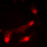 Polyclonal Rabbit anti-Human TP53 / p53 Antibody (Acetyl-Lys386, IHC, IF, WB)