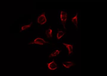 ER Alpha / Estrogen Receptor Antibody (phospho-Tyr537)